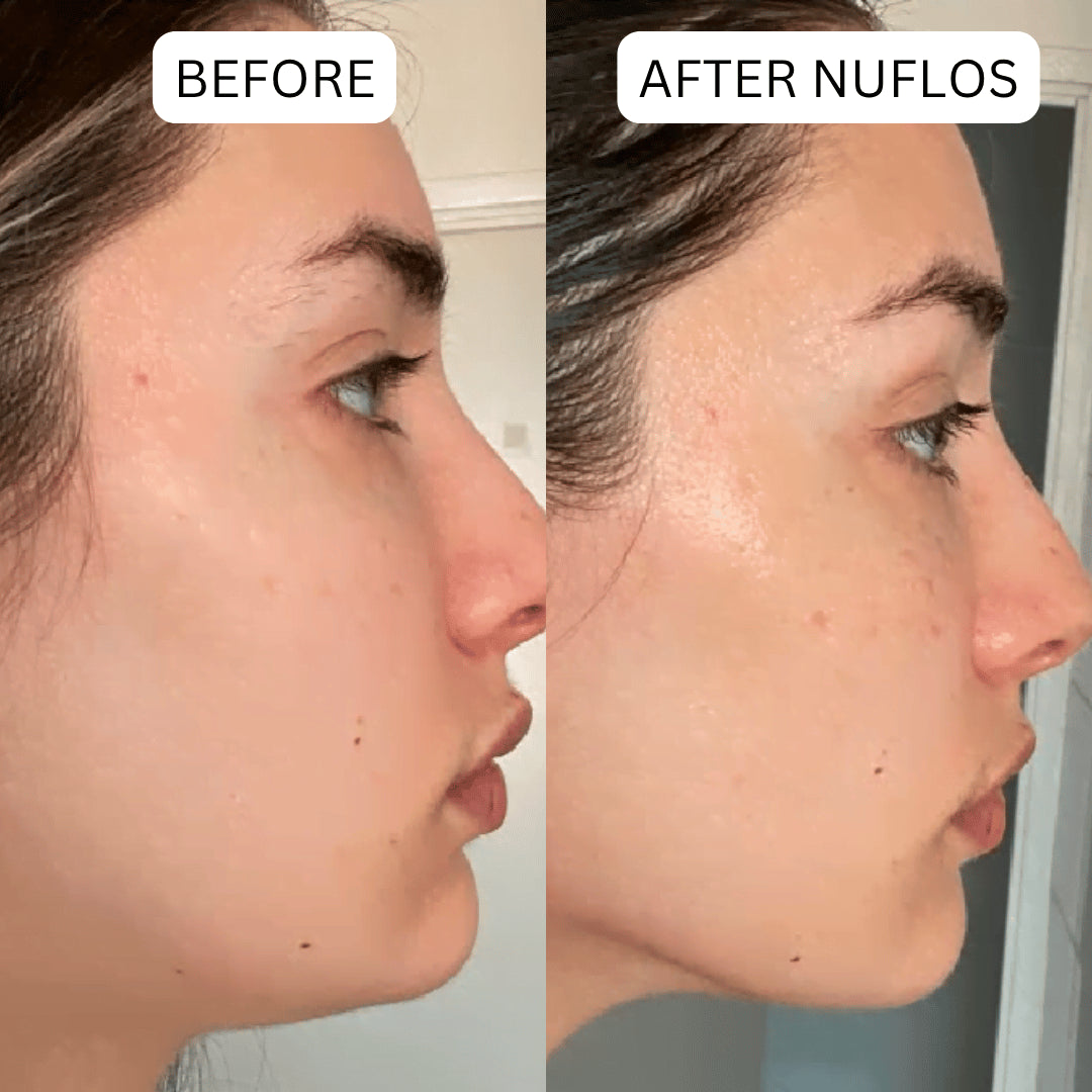Triplechic™ Nuflos Sculpt – 5 Min Electric Guasha for Face & Body