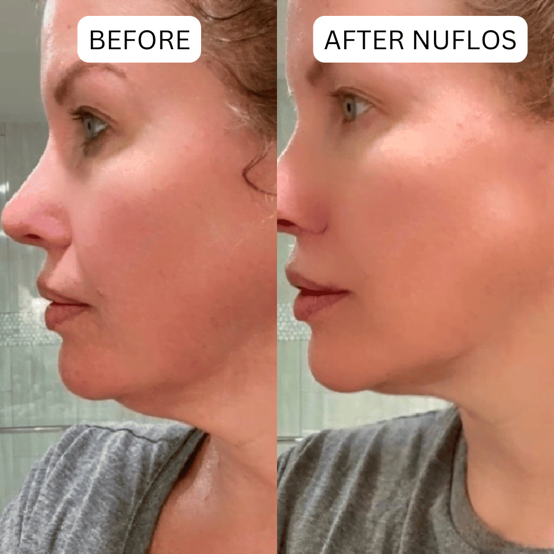 Triplechic™ Nuflos Sculpt – 5 Min Electric Guasha for Face & Body