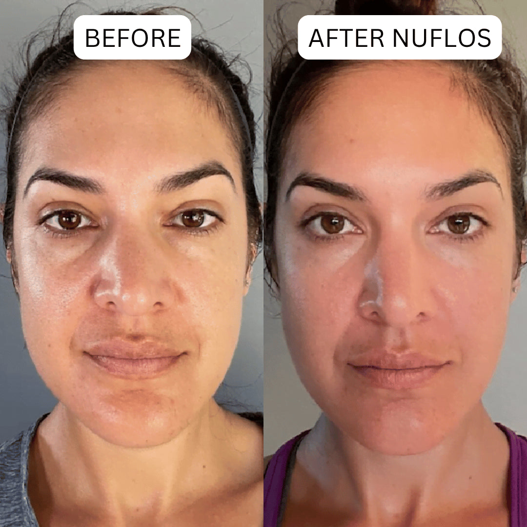 Triplechic™ Nuflos Sculpt – 5 Min Electric Guasha for Face & Body
