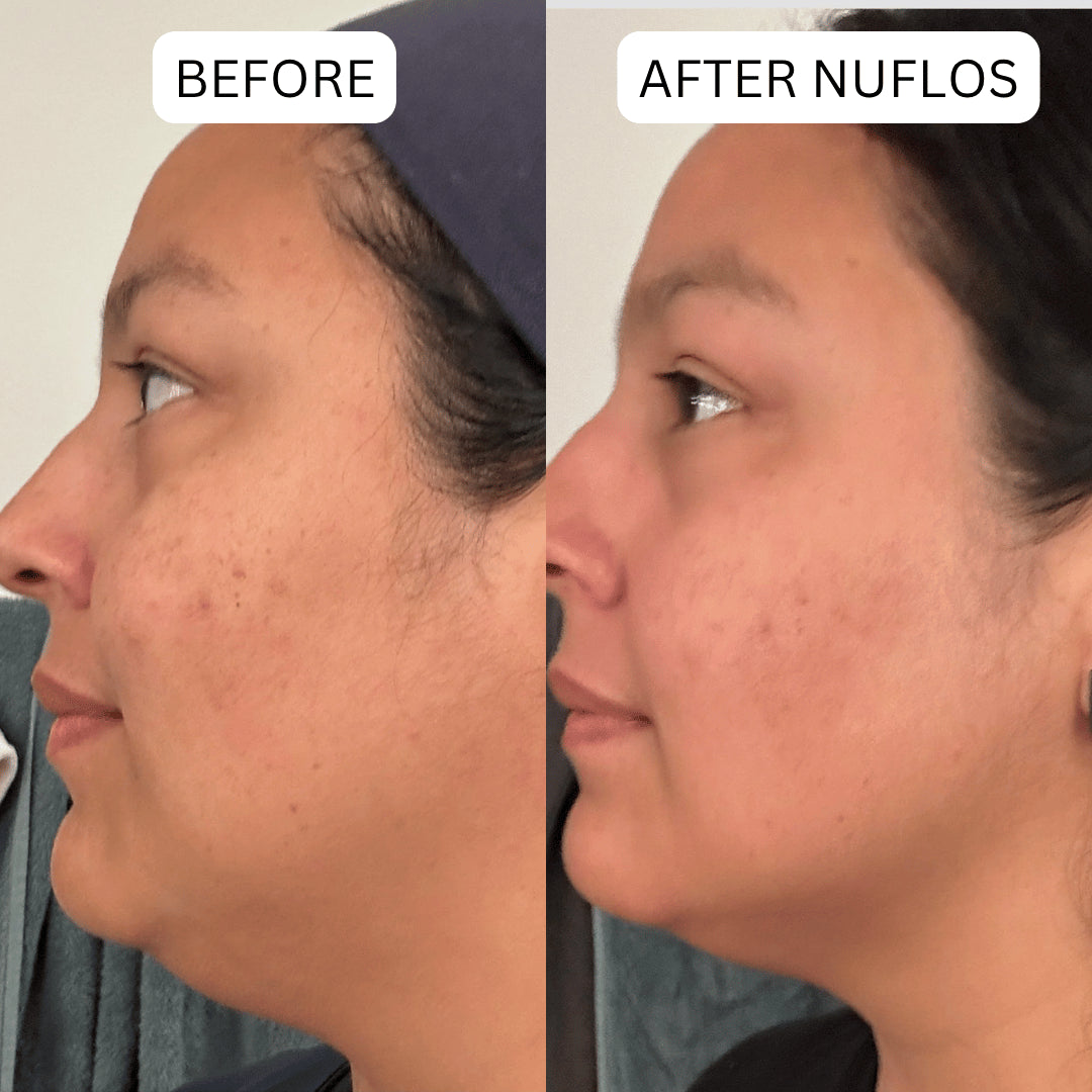 Triplechic™ Nuflos Sculpt – 5 Min Electric Guasha for Face & Body