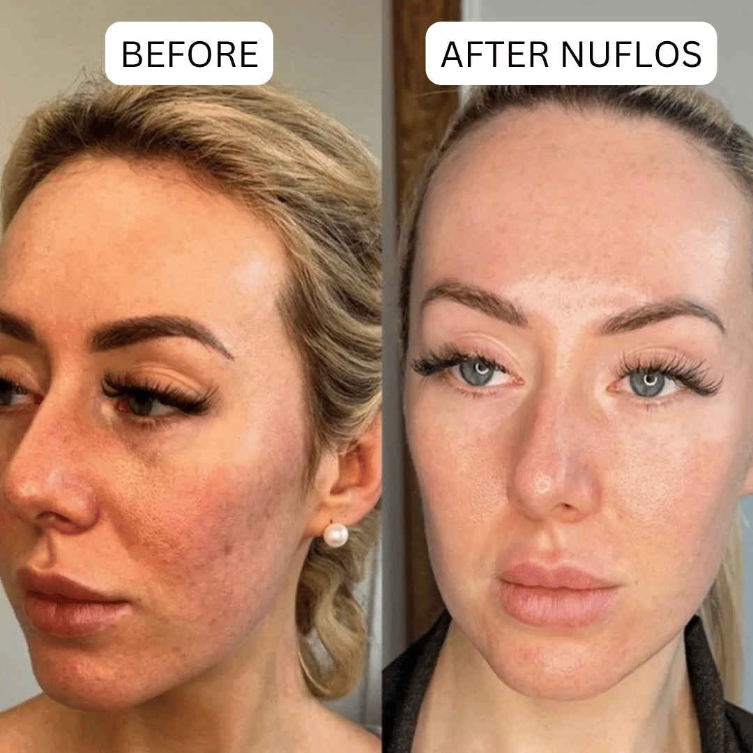 Triplechic™ Nuflos Sculpt – 5 Min Electric Guasha for Face & Body
