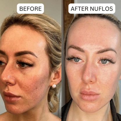 Triplechic™ Nuflos Sculpt – 5 Min Electric Guasha for Face & Body