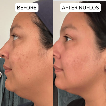 Triplechic™ Nuflos Sculpt – 5 Min Electric Guasha for Face & Body