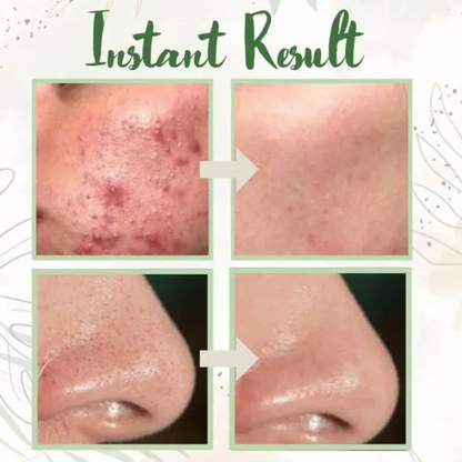 Triplechic™ Green Tea Deep Cleanse Mask
