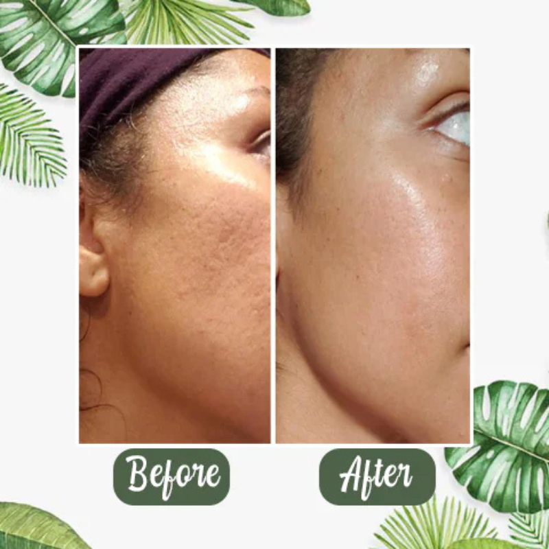 Triplechic™ Green Tea Deep Cleanse Mask