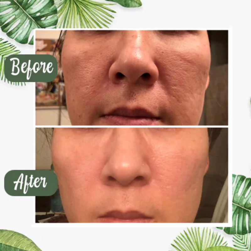 Triplechic™ Green Tea Deep Cleanse Mask